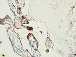 factor 13 Antibody in Immunohistochemistry (Paraffin) (IHC (P))