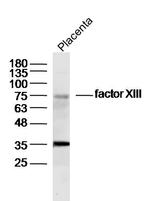 factor 13 Antibody in Western Blot (WB)