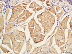 CK20 Antibody in Immunohistochemistry (Paraffin) (IHC (P))