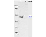 CK20 Antibody in Western Blot (WB)