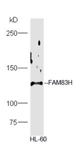FAM83H Antibody in Western Blot (WB)