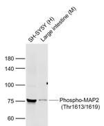 Phospho-MAP2 (Thr1613, 1619) Antibody in Western Blot (WB)