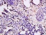 FKLF Antibody in Immunohistochemistry (Paraffin) (IHC (P))