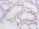 SATB1 Antibody in Immunohistochemistry (Paraffin) (IHC (P))
