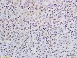 SATB1 Antibody in Immunohistochemistry (Paraffin) (IHC (P))