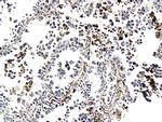 CK7 Antibody in Immunohistochemistry (Paraffin) (IHC (P))