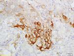 CK7 Antibody in Immunohistochemistry (Paraffin) (IHC (P))