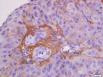 CK7 Antibody in Immunohistochemistry (Paraffin) (IHC (P))