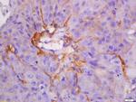 CK7 Antibody in Immunohistochemistry (Paraffin) (IHC (P))