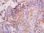 CK7 Antibody in Immunohistochemistry (Paraffin) (IHC (P))