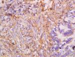 CK7 Antibody in Immunohistochemistry (Paraffin) (IHC (P))