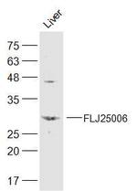 SGK494 Antibody in Western Blot (WB)