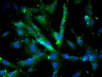 Cathepsin D/CTSD Antibody in Immunocytochemistry (ICC/IF)