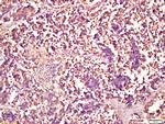 Smad1 + Smad5 Antibody in Immunohistochemistry (Paraffin) (IHC (P))