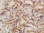 GLIS3 Antibody in Immunohistochemistry (Paraffin) (IHC (P))
