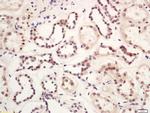 GLIS3 Antibody in Immunohistochemistry (Paraffin) (IHC (P))