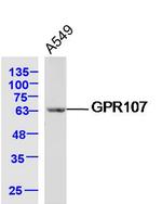 GPR107 Antibody in Western Blot (WB)