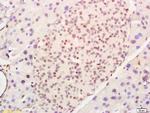 CEBP-alpha Antibody in Immunohistochemistry (Paraffin) (IHC (P))
