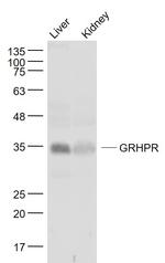 GRHPR Antibody in Western Blot (WB)
