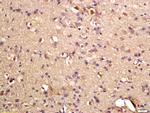 Phospho-GRLF1 (Tyr1087) Antibody in Immunohistochemistry (Paraffin) (IHC (P))