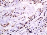GSDMA Antibody in Immunohistochemistry (Paraffin) (IHC (P))