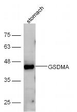 GSDMA Antibody in Western Blot (WB)