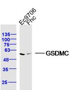 GSDMC Antibody in Western Blot (WB)