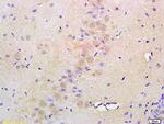 ATF6 Antibody in Immunohistochemistry (Paraffin) (IHC (P))