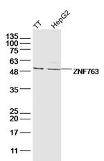 ZNF763 Antibody in Western Blot (WB)