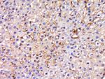 HIATL1 Antibody in Immunohistochemistry (Paraffin) (IHC (P))