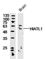 HIATL1 Antibody in Western Blot (WB)