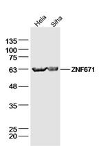 ZNF671 Antibody in Western Blot (WB)