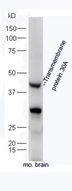 Transmembrane protein 30A Antibody in Western Blot (WB)