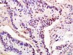 THOC2 Antibody in Immunohistochemistry (Paraffin) (IHC (P))