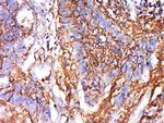 IRGQ Antibody in Immunohistochemistry (Paraffin) (IHC (P))
