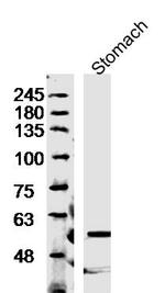 Trehalase Antibody in Western Blot (WB)