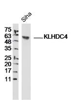 KLHDC4 Antibody in Western Blot (WB)