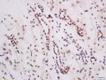 DOT1L Antibody in Immunohistochemistry (Paraffin) (IHC (P))