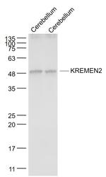 KREMEN2 Antibody in Western Blot (WB)