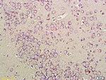 CNR1/CB1 Antibody in Immunohistochemistry (Paraffin) (IHC (P))