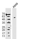 DAPK3 Antibody in Western Blot (WB)