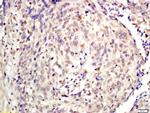 KDM5A Antibody in Immunohistochemistry (Paraffin) (IHC (P))