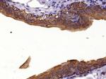 pan Cytokeratin Antibody in Immunohistochemistry (Paraffin) (IHC (P))