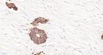 pan Cytokeratin Antibody in Immunohistochemistry (Paraffin) (IHC (P))