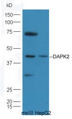 DAPK1/2 Antibody in Western Blot (WB)