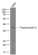 Tropomodulin 2 Antibody in Western Blot (WB)