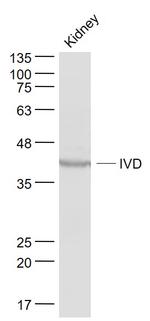 IVD Antibody in Western Blot (WB)