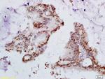 HPV16 E6 + HPV18 E6 Antibody in Immunohistochemistry (Paraffin) (IHC (P))