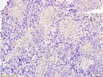 JUP/gamma Catenin Antibody in Immunohistochemistry (Paraffin) (IHC (P))