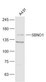 SBNO1 Antibody in Western Blot (WB)